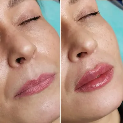 Ale cudnie - Kosmetologia estetyczna